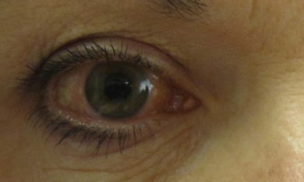 El Rincón del IMSS: Glaucoma causa ceguera irreversible