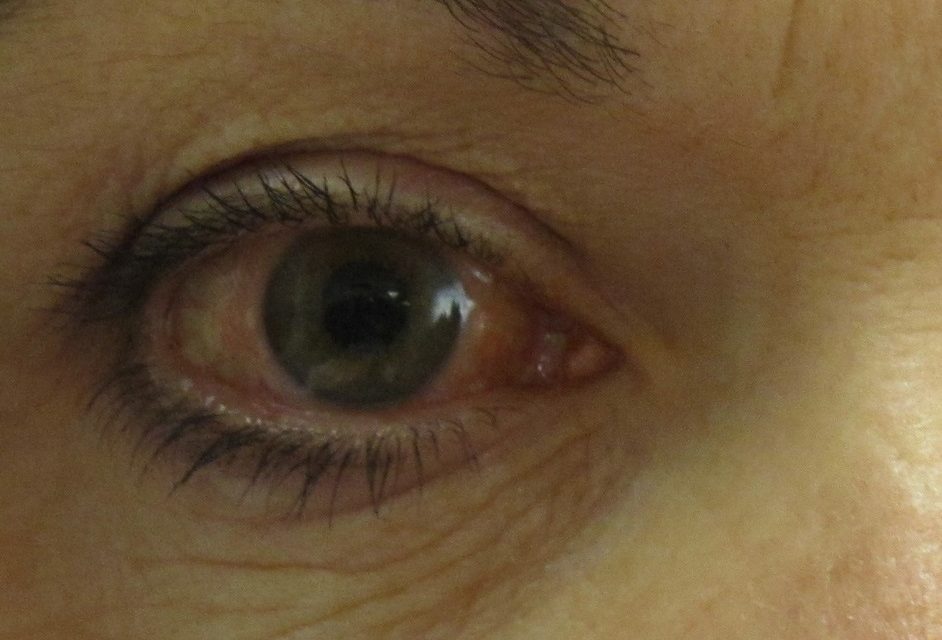 El Rincón del IMSS: Glaucoma causa ceguera irreversible