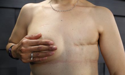 El Rincón del IMSS: Hombres también deben prevenir cáncer de mama