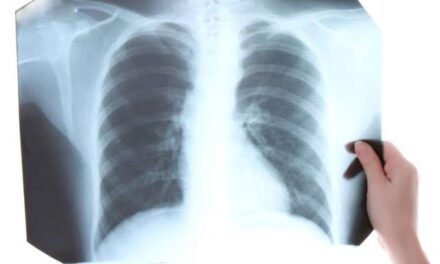 El Rincón del IMSS: ¿Qué es la tuberculosis?