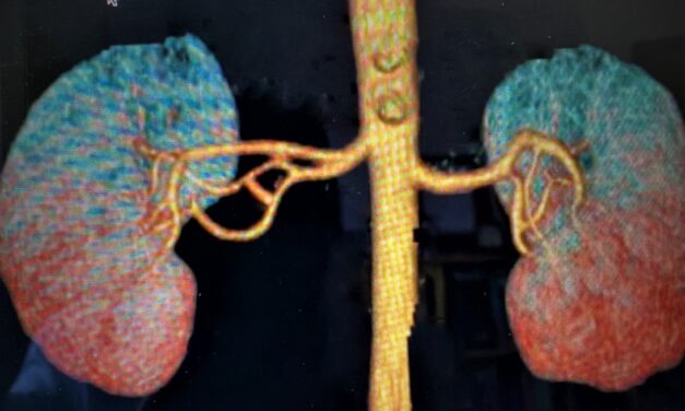 ¡Súmate! Participa en la donación de órganos